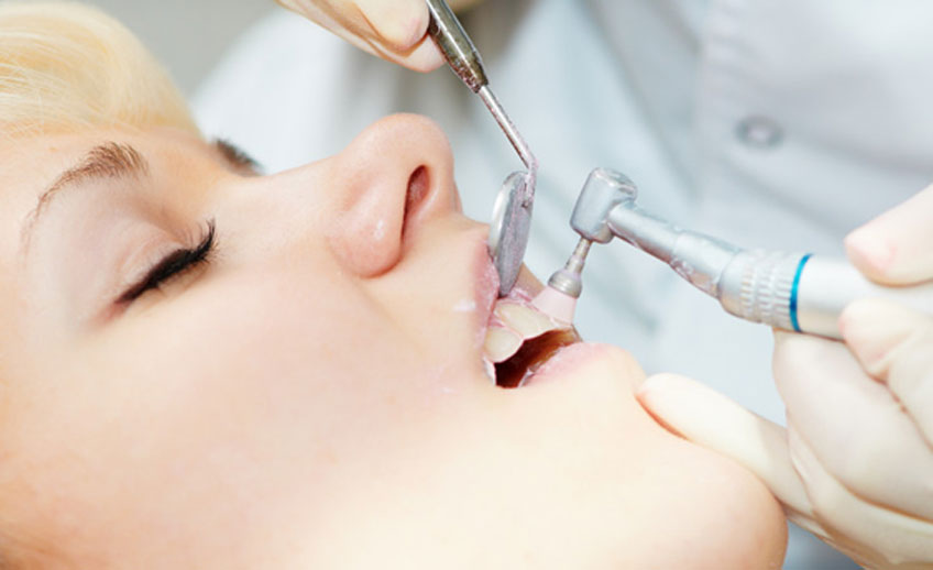 Scaling & Polishing Dental Treatments in Vadodara