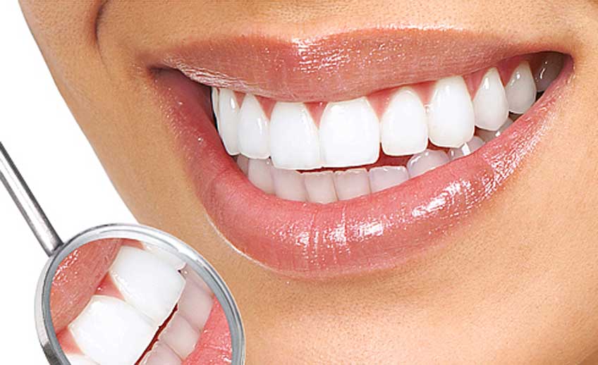 Gum Reshaping & Contouring in VadodaraMonarch Dental Clinic