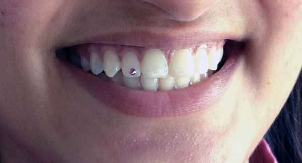After-Tooth Jewelry